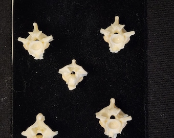 Lot of 5 / Boa Constrictor Snake Vertebrae / Jumbo Large - MBD Pathology Deformed