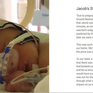 May include: A premature infant lies in a hospital bed, connected to medical equipment. A breathing tube is inserted, and a head support is in place. The image is a close-up, showing the baby's face and the medical apparatus.