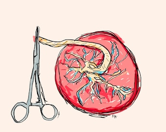 Dibujo digital, impresión artística de placenta