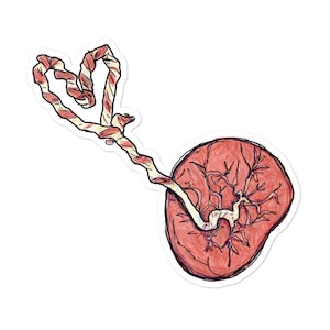 May include: A hand-drawn illustration of a uterus with a fallopian tube attached. The uterus is red and the fallopian tube is white with red stripes. The illustration is done in a cartoon style.