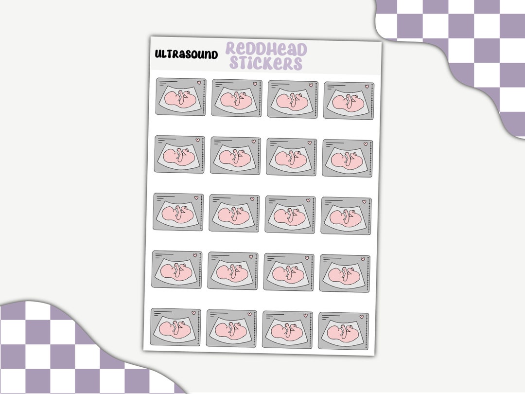 Ultrasound Planner Stickers Pregnancy Stickers Parenthood Stickers ...