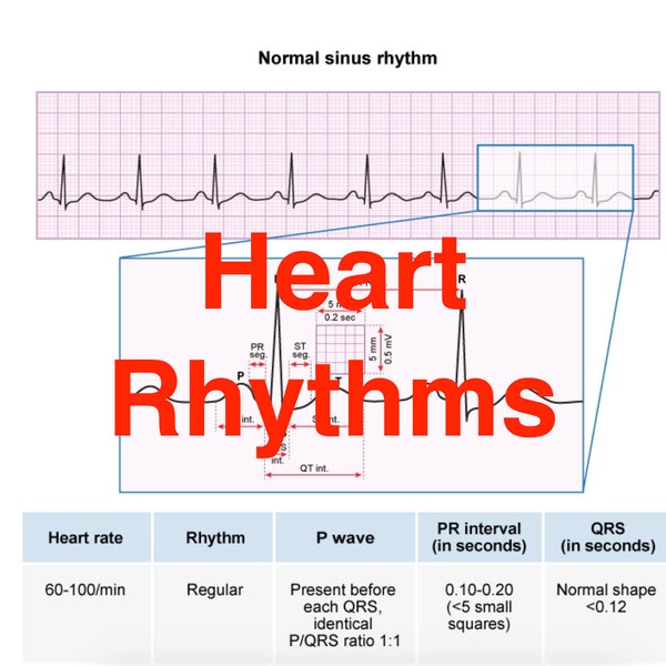 Heart Rhythms