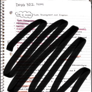Puede incluir: Notas escritas a mano en una página de cuaderno rayada sobre el desarrollo y la erupción de los dientes. Las notas incluyen términos como "odontogénesis", "denticion", "primaria", "oclusión", "etapas", "erupción", "desarrollo", "displasia", "germen", "macrodoncia" y "microdoncia".