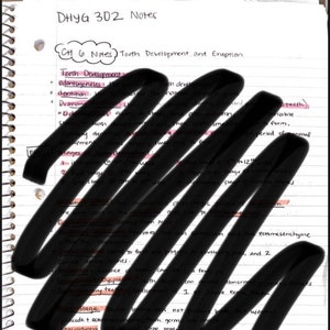 May include: A handwritten page of notes on tooth development and eruption. The notes include terms like "odontogenesis", "dentition", "primary", "secondary", "eruption", "stages", "macrodontia", and "microdontia".