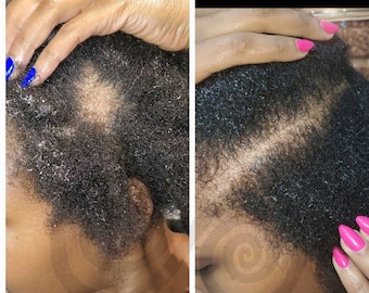 Hair Growth Oil - Helps Reduce Hair Fall - DHT Blocker, Thicker Hair Growth, For All Hair Types, Natural, Vegan - Includes Free Applicator