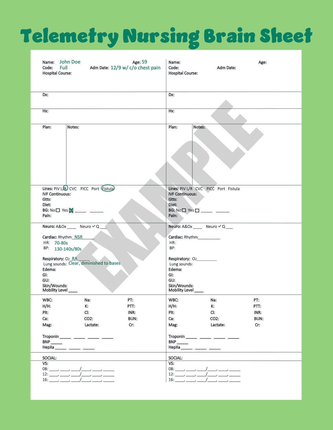 Telemetry Nursing Brain/report Sheet Printable PDF Etsy