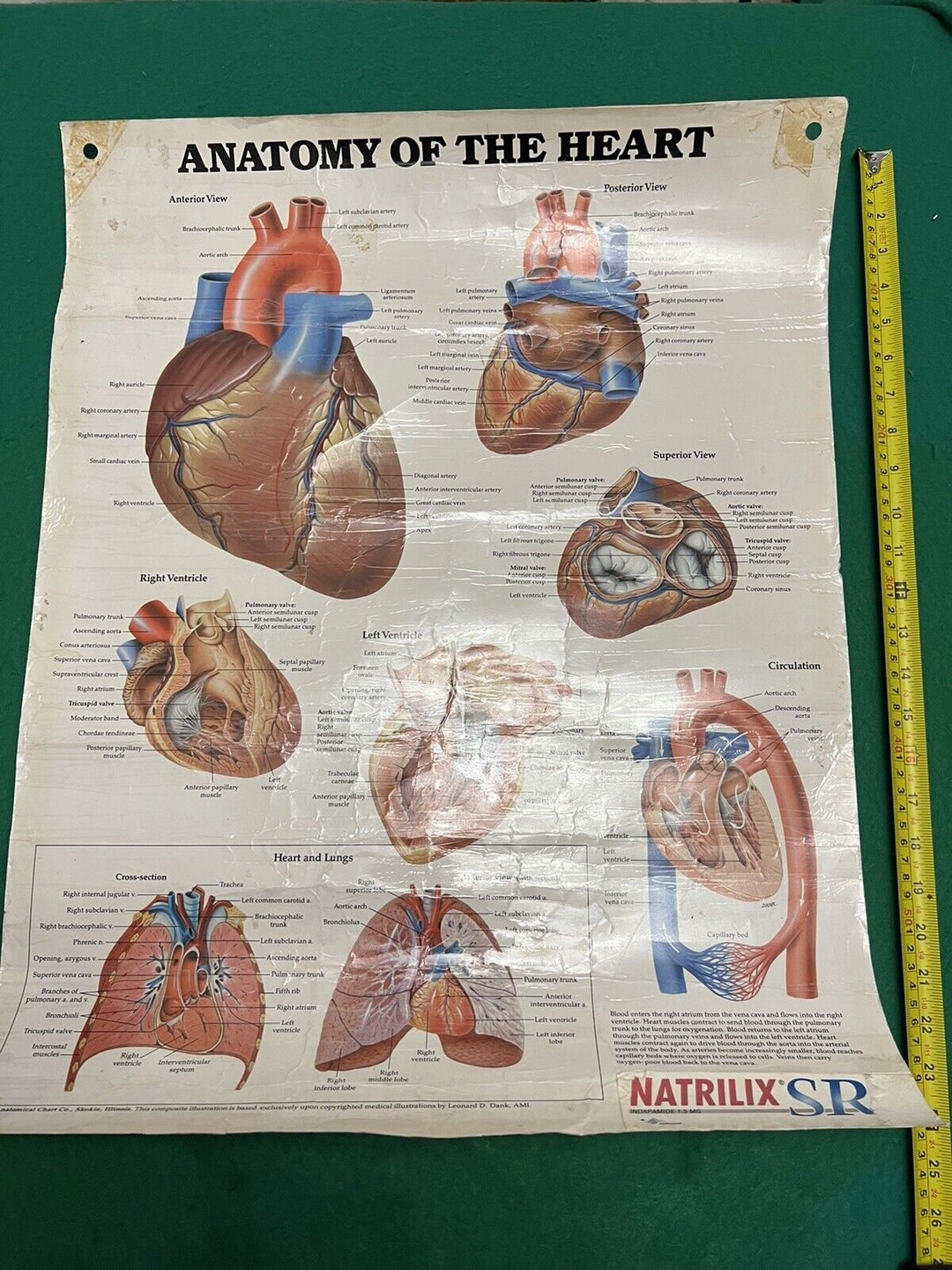 Vintage American Anatomy of the Heart Poster - Etsy