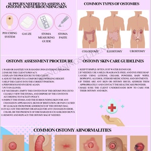 May include: A pink and white infographic with the title "How to Assess an Ostomy Stoma & Surrounding Skin". The infographic includes a list of supplies needed to assess an ostomy and surrounding skin, common types of ostomies, an ostomy assessment procedure, ostomy skin care guidelines, and common ostomy abnormalities. The infographic also includes illustrations of the different types of ostomies and common ostomy abnormalities.