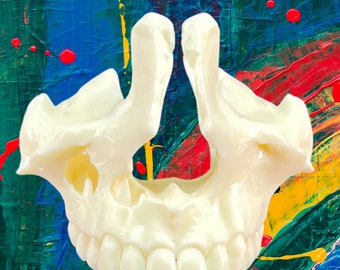 Maxillary Dental Model: Normal vs. Cystic Pathology Educational Visual Aid 3D Printed