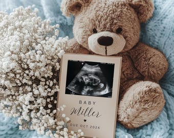 Its a Boy Pregnancy Announcement Digital Template: Editable Canva Social Media Little Brother Announcement Simple