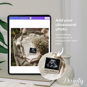 May include: A digital tablet displays a baby announcement design. The design includes a beige onesie with "coming soon" text, an ultrasound photo, and a bouquet of white flowers. A separate ultrasound photo is also shown. Text on the image says "Add your ultrasound photo."