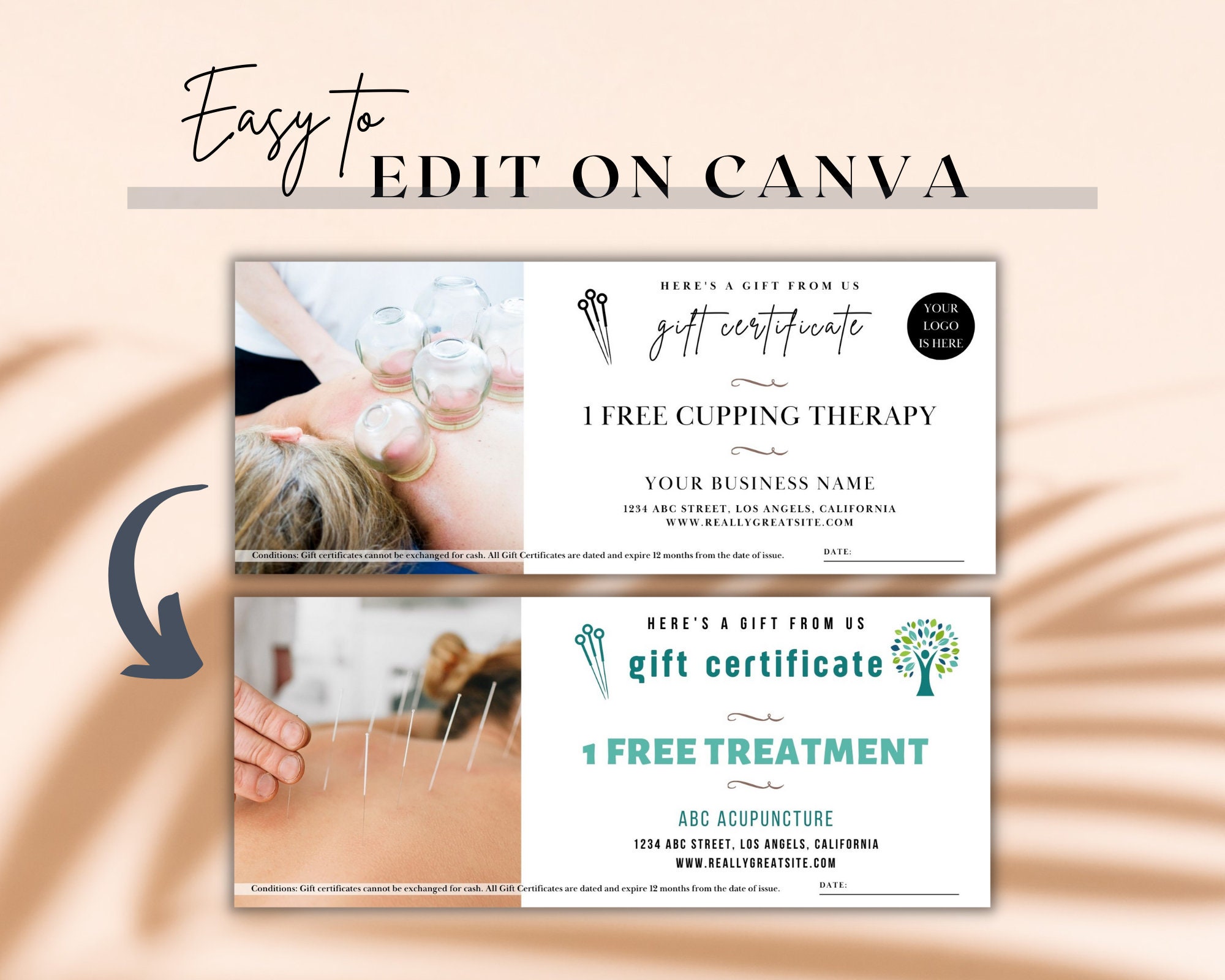 Acupuncture Gift Certificate Templates is Perfect Acupuncture Gift for