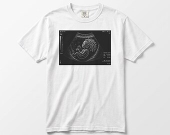 Locs Baby Ultrasound T-Shirt, Dreadlocks Streetwear Graphic Tee, Natural Hair Culture Shirt, Comfort Colors, Heavyweight Street Tee