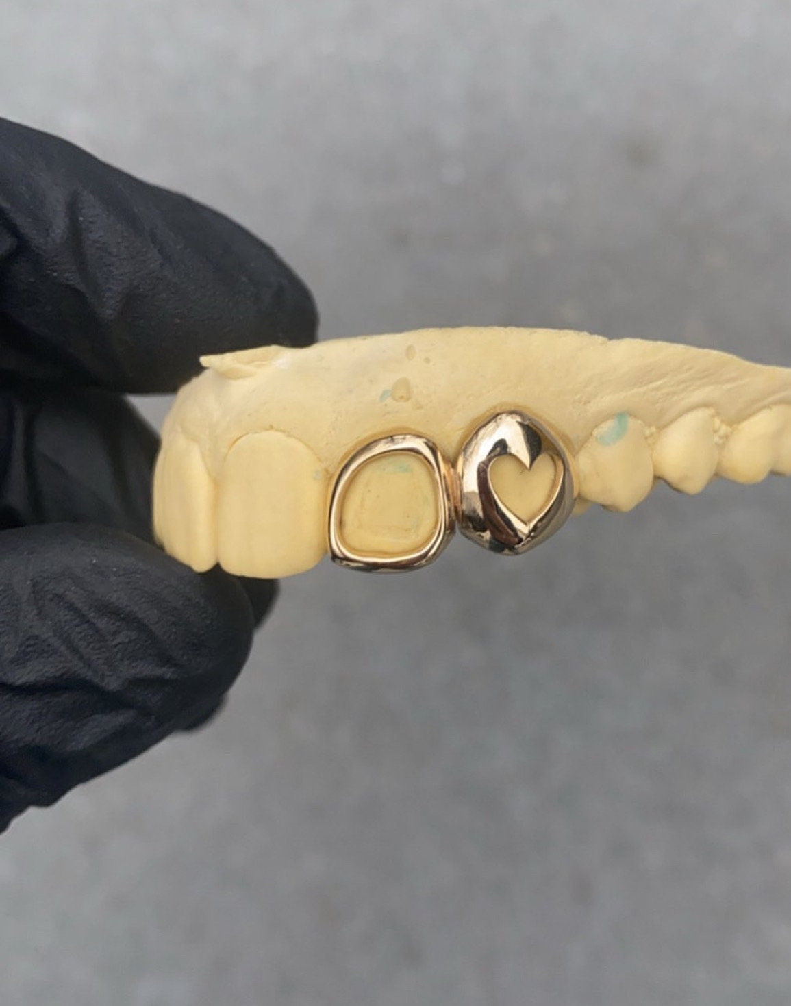 Custom Double Solid Window Grillz , Gold Tooth Cap , Gold Teeth