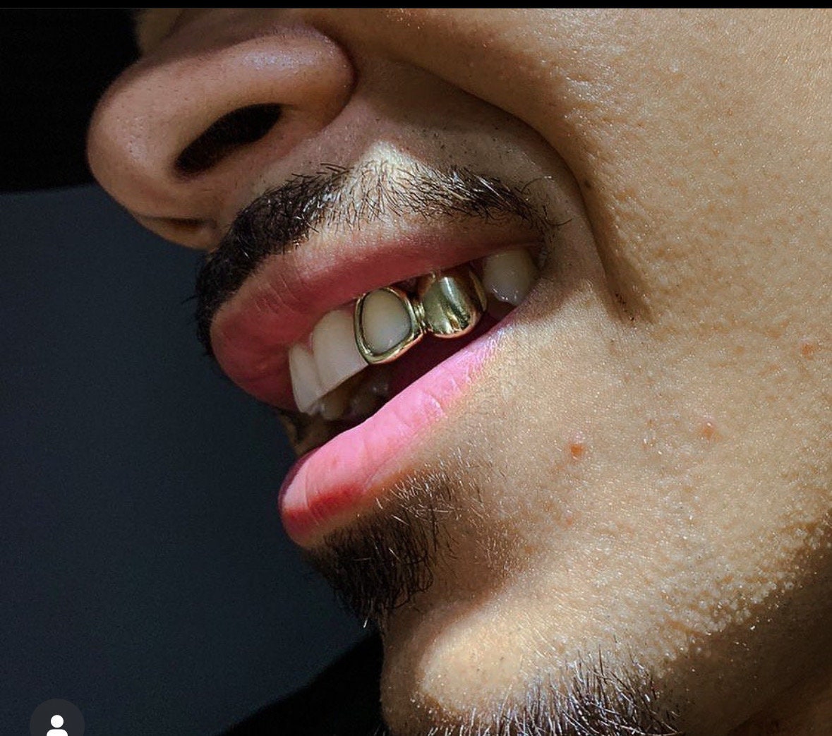 Custom Double Solid Window Grillz , Gold Tooth Cap , Gold Teeth