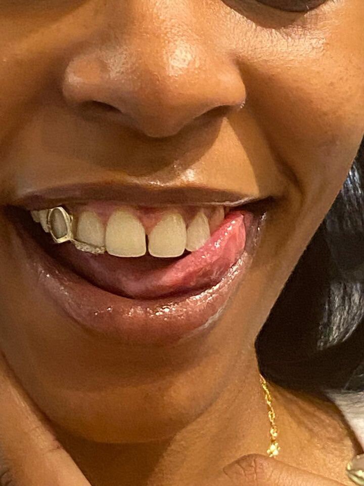 Custom Grillz , Jorja Window Diamond Inlay Grillz , Real Diamond Grillz , Vs1 Diamonds , Gold