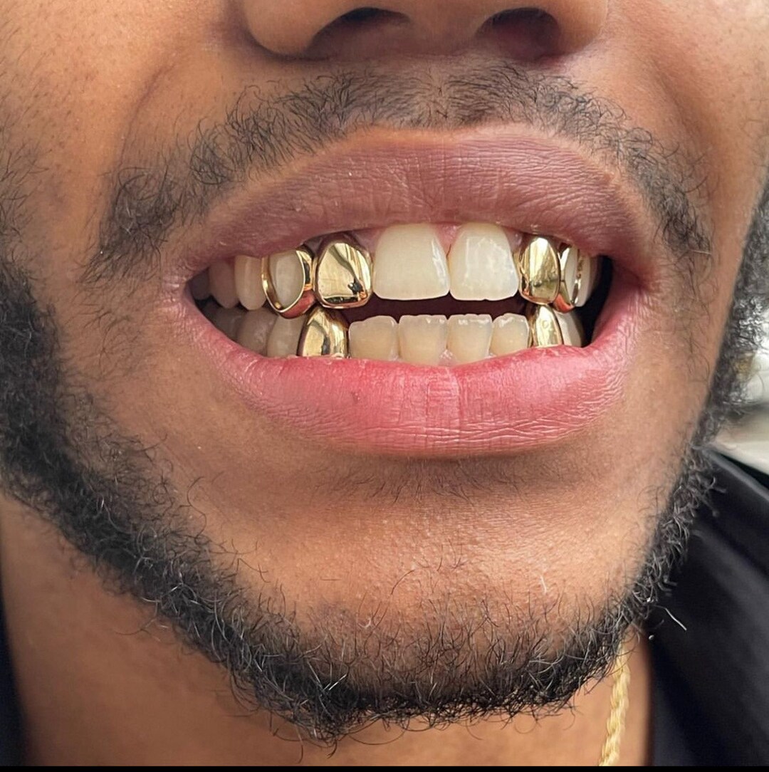 Custom Grillz Set , Top 4 Bottom 2 Grillz Set , Gold Tooth Cap Set