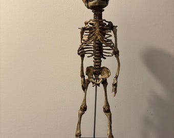 May include: A complete human skeleton of a baby, mounted on a black base. The skeleton is articulated and posed standing. The skull is detailed and shows the features of a baby.