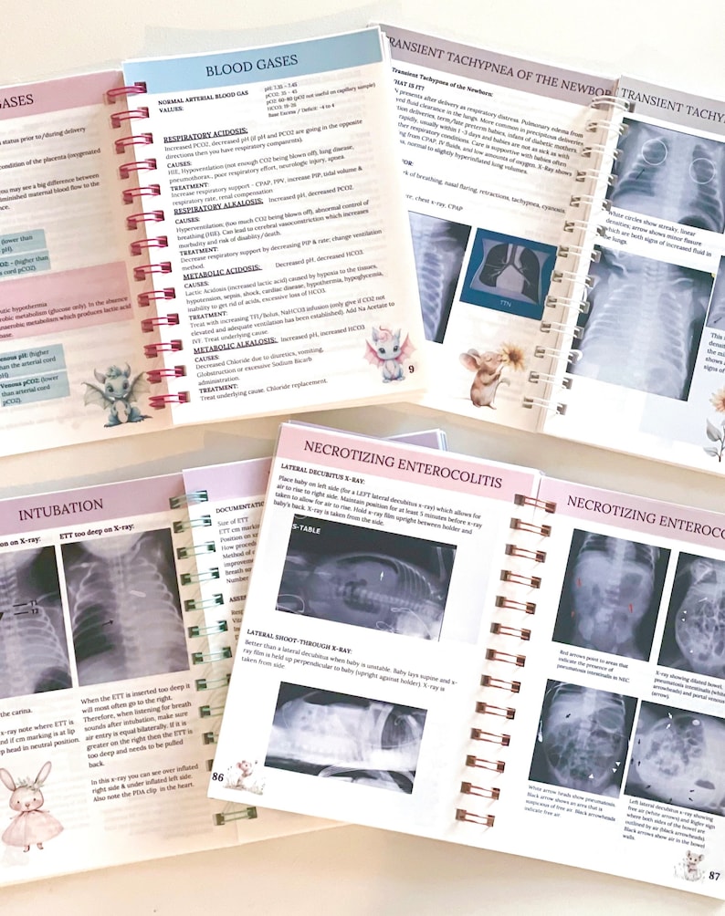 Neonatal Intensive Care NICU Resource 2026 Information Learning Book Guide RNC review, new nurse, hospitals; Infant Newborn Neonate Nursing image 2