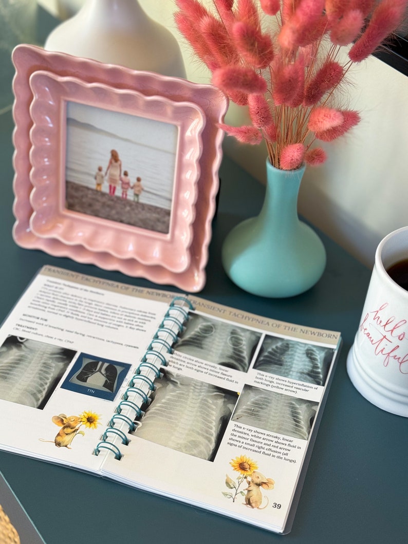 May include: An open book with a teal spiral binding. The book is titled "Transient Tachypnea of the Newborn". The pages contain black and white x-ray images of a baby's lungs. The book is open to a page with a sunflower and a mouse illustration.