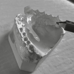 Missing Teeth Custom Fitted Space Filler Cosmetic Temporary Tooth Smile Repair