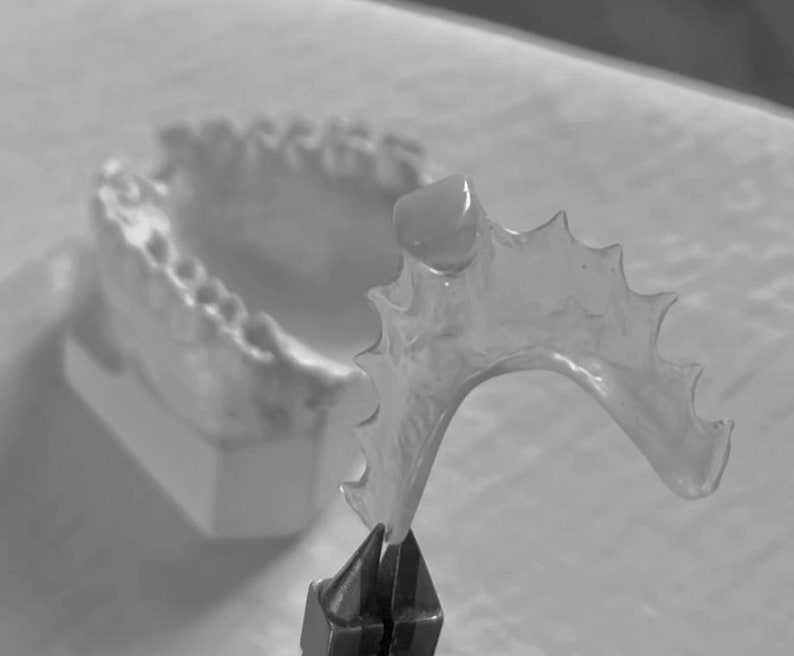 Flipper Nesbit Impression Kit Missing Tooth Space Filler Cosmetic