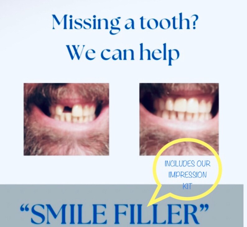 Flipper Nesbit Custom Fitted Missing Teeth Space Filler Etsy