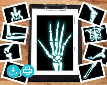 Ausdruckbare Röntgenbilder für Kinder. Rollenspiel Kinder-Röntgenbild für spielende Ärzte und Krankenschwestern / Krankenpfleger. Drucken Sie zu Hause Ärzte spielen Kit.