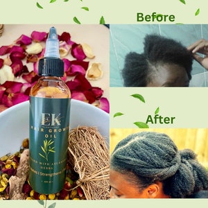 Ayurvedic Hair Growth Oil. Nourishes and relieves dry, itchy and sensitive scalps. Eliminates dandruff and promotes hair growth.