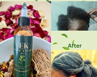 Aceite ayurvédico para el crecimiento del cabello: tratamiento natural a base de hierbas para el cuero cabelludo