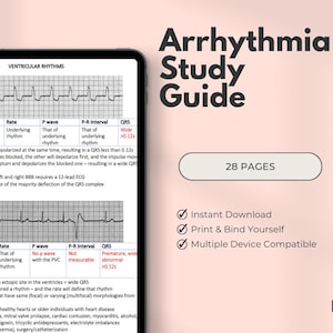 Cardiac Arrhythmia Study Guide