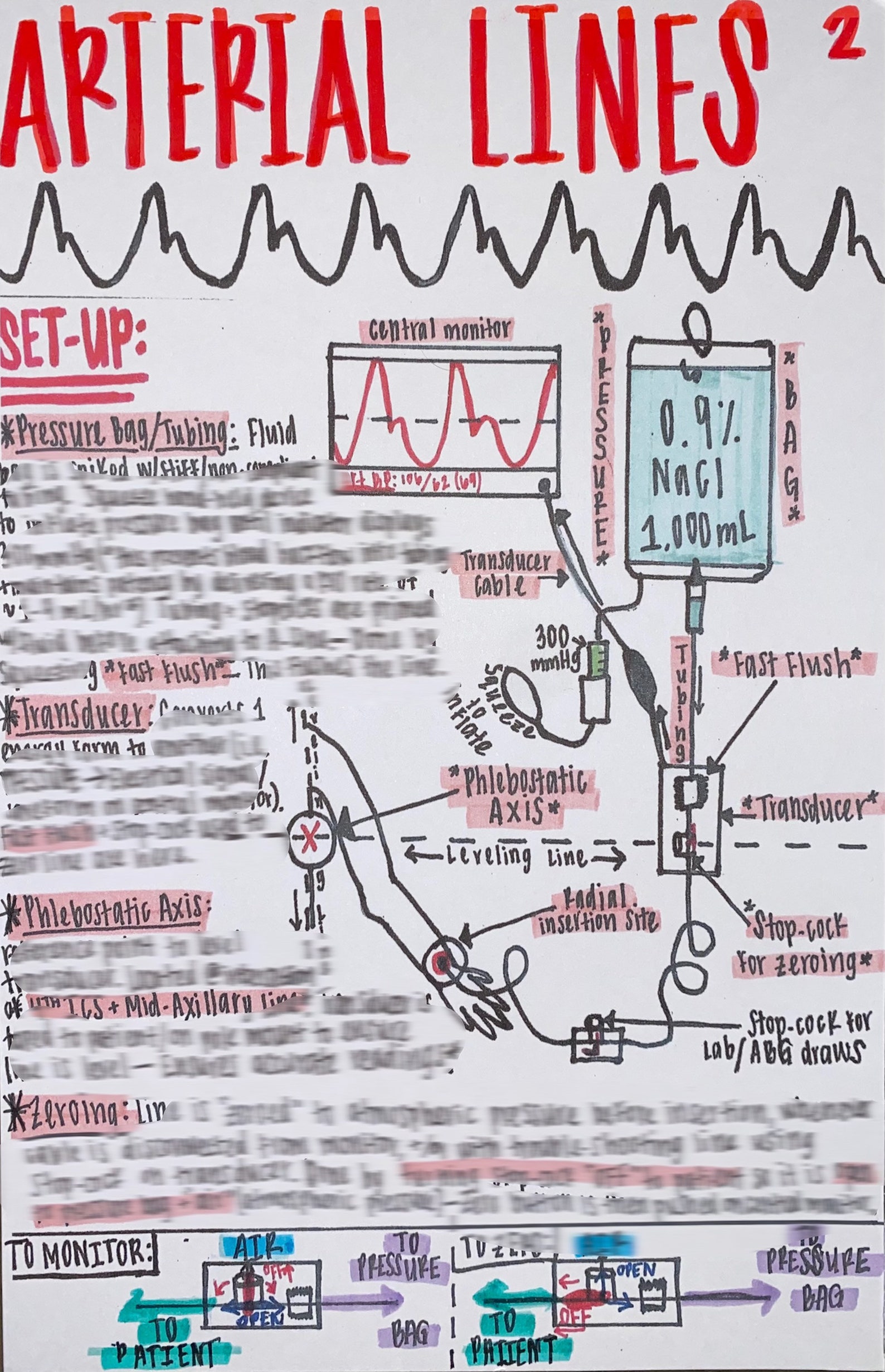 Arterial Line ICU Nurse Reference Sheet Etsy