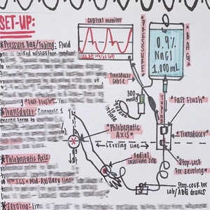 Arterial Line ICU Nurse Reference Sheet