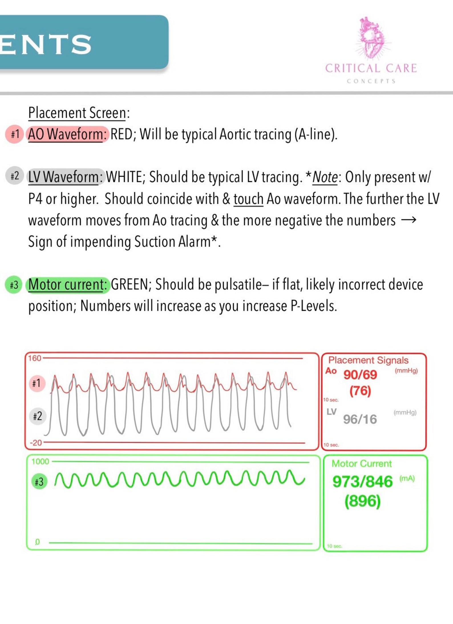 Impella ICU Nurse Reference Etsy