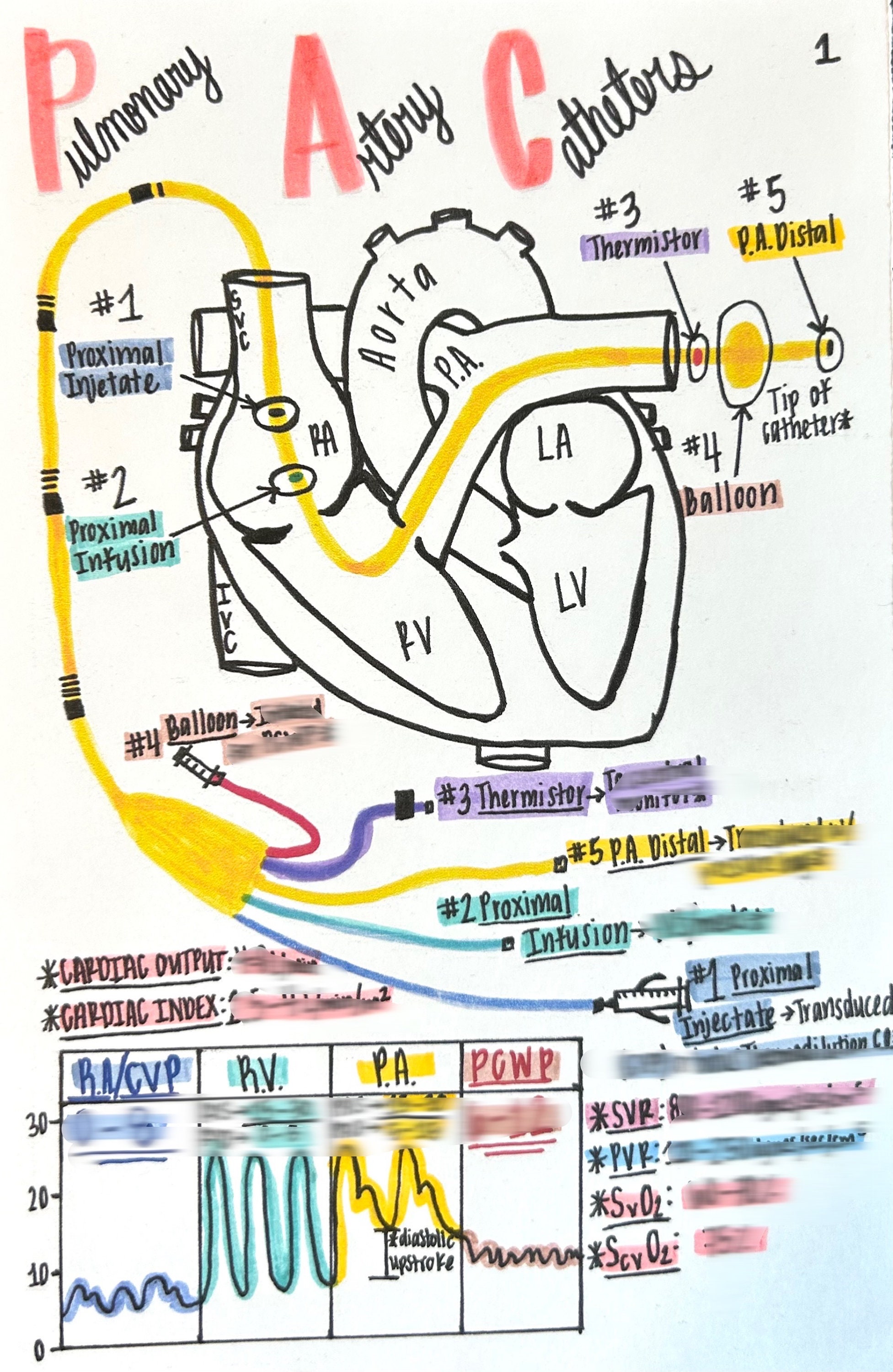 Pulmonary Artery Catheter Waveforms