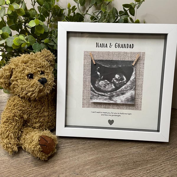 Baby Scan Frame - Etsy UK