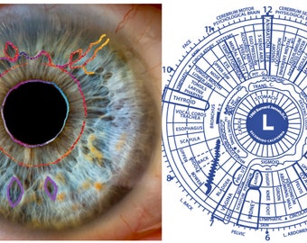 At A Glance Iris Reading | 15 Minute Iridology Video | Discover Constitutional Strength, Unique Iris Markings, Health of Organs & Glands