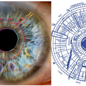 Iridology Mentorship Certification One on One Mentorship Case Studies May Include Include Yourself, Friends & Family image 3