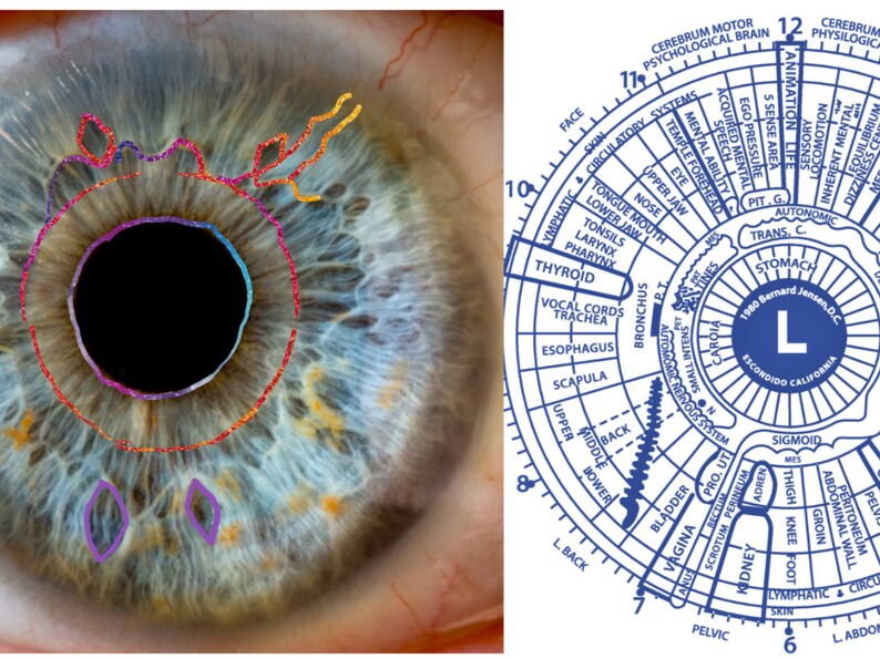 Iridology Mentorship Certification One on One Mentorship Case Studies May Include Include Yourself, Friends & Family image 3