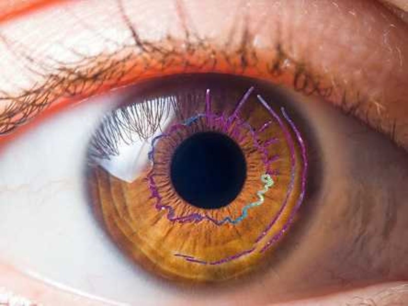 Iridology Mentorship Certification One on One Mentorship Case Studies May Include Include Yourself, Friends & Family image 2