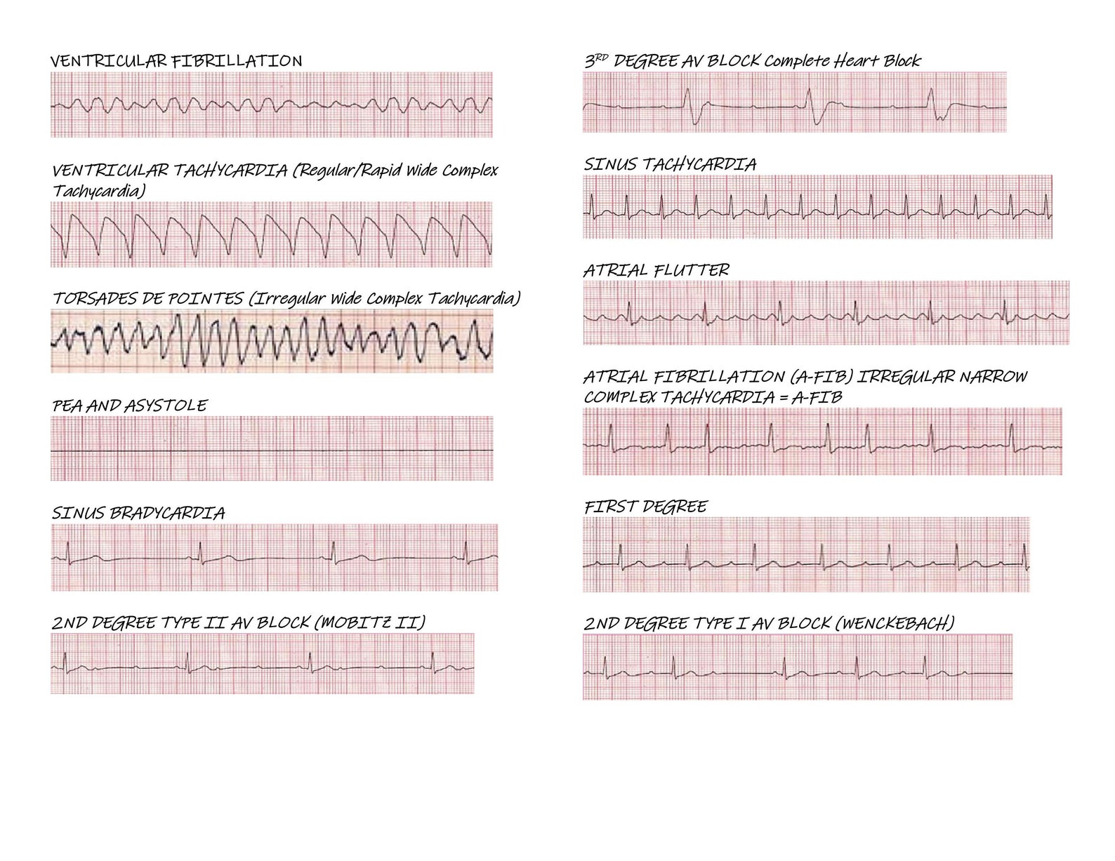 cardiac-rhythm-examples-etsy