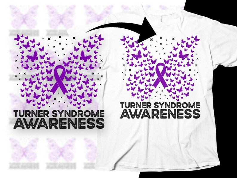 Turner Syndrome Awareness Svg Png Turner Syndrome Butterfly Etsy