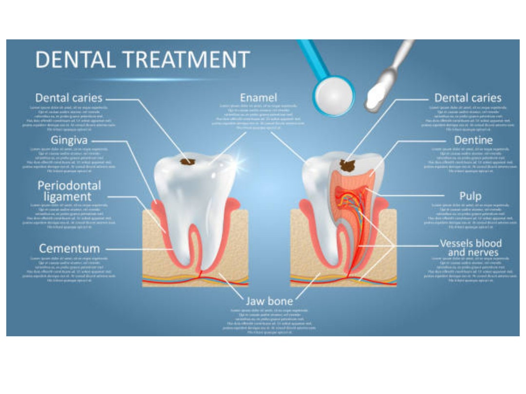 Dental Treatment Chart and Study Guide - Etsy