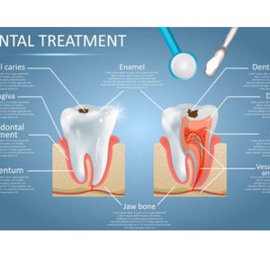 Cuadro de tratamiento dental y guía de estudio