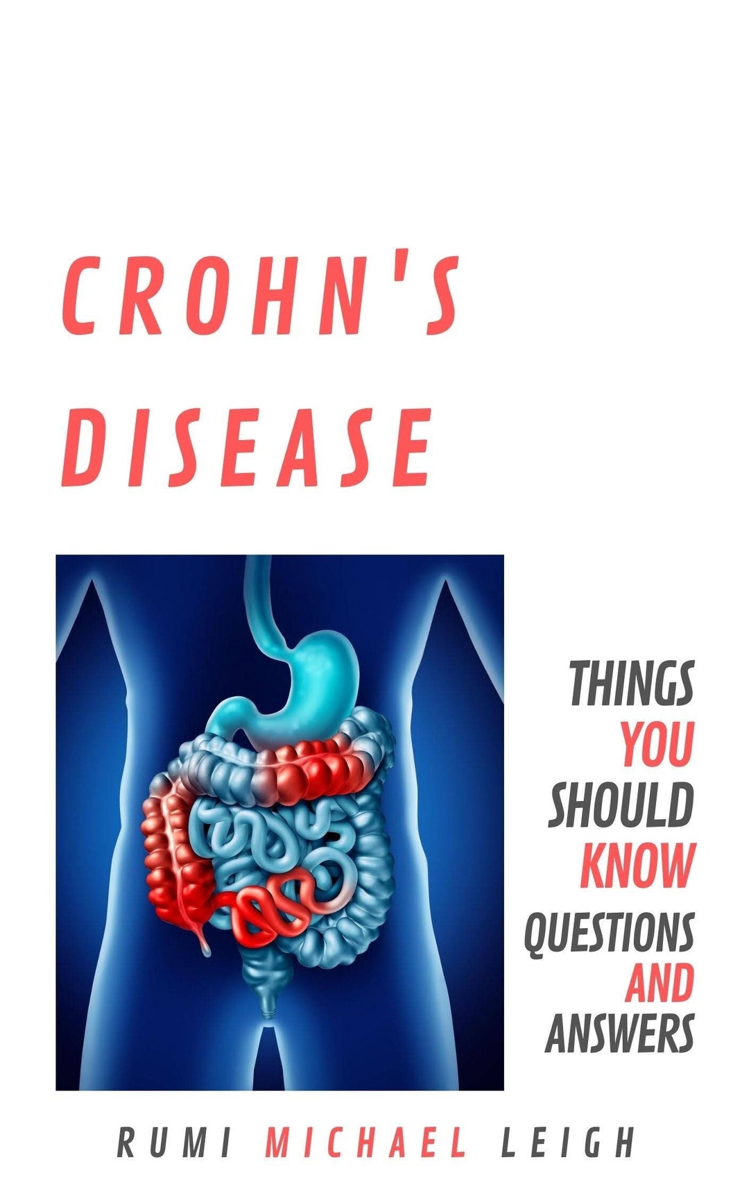 Crohn's Disease Things You Should Know questions and Answers Etsy