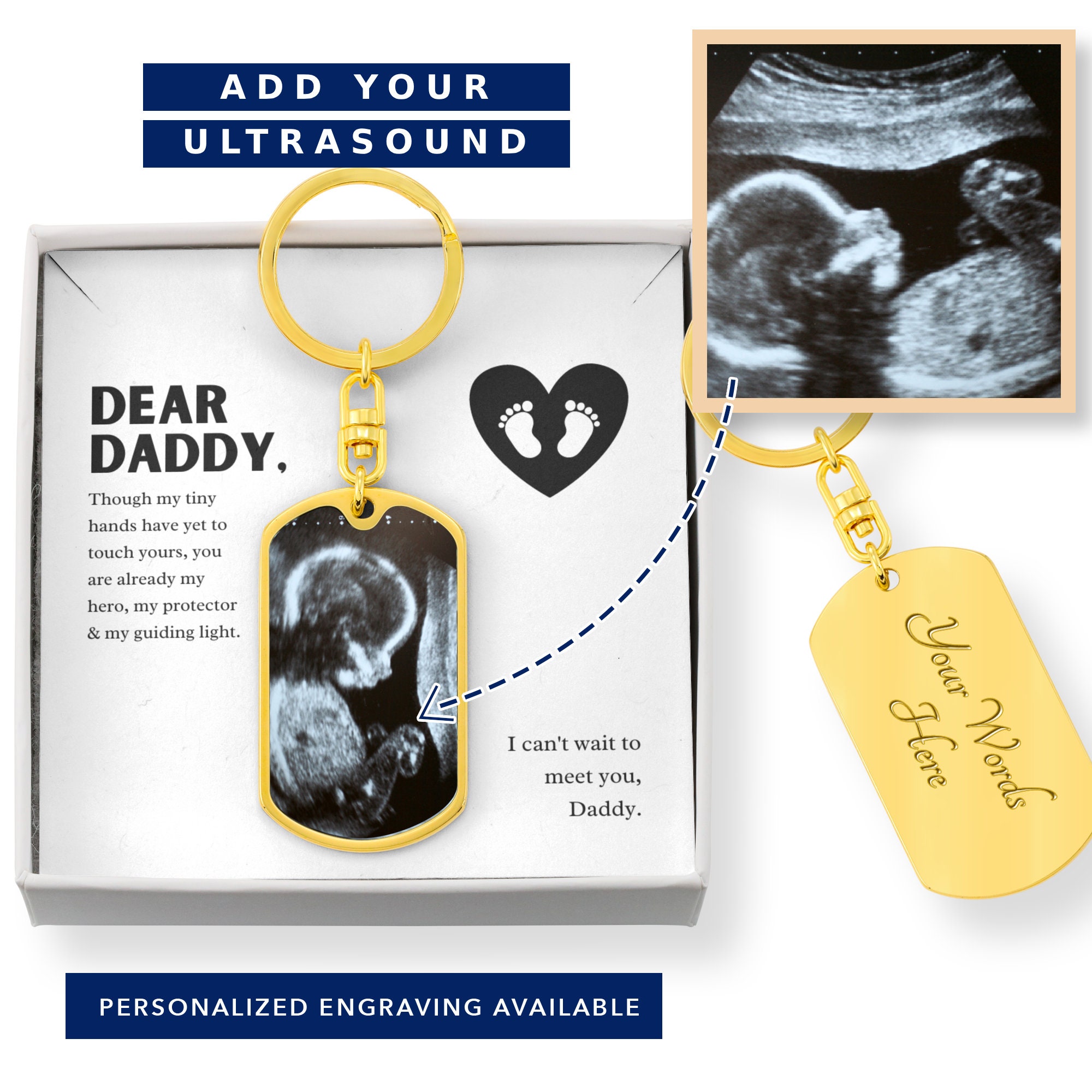 DaintyJewelCoGifts Dear Daddy Personalized First Time Dad Gift Ultrasound Keychain, 1st Time Dad Gift, Expecting Dad Gifts New Dad Gift, Soon to Be Daddy