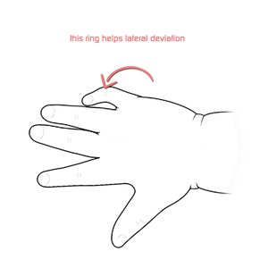 K&ouml;nnte beinhalten: Eine Hand mit einem Ring am Zeigefinger. Der Text "This ring helps lateral deviation" steht &uuml;ber der Hand.