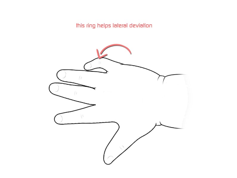 K&ouml;nnte beinhalten: Eine Hand mit einem Ring am Zeigefinger. Der Text "This ring helps lateral deviation" steht &uuml;ber der Hand.