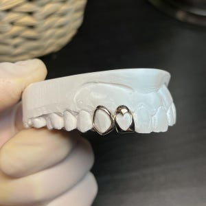 May include: Gold-coloured dental caps, one with a heart-shaped cutout, sit on a white dental mould. The caps are highly polished and reflect light, showcasing a unique design. The dental mould is a detailed replica of teeth.