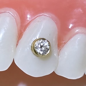 歯チャーム ゴールド 18K ダイヤモンド ベゼル